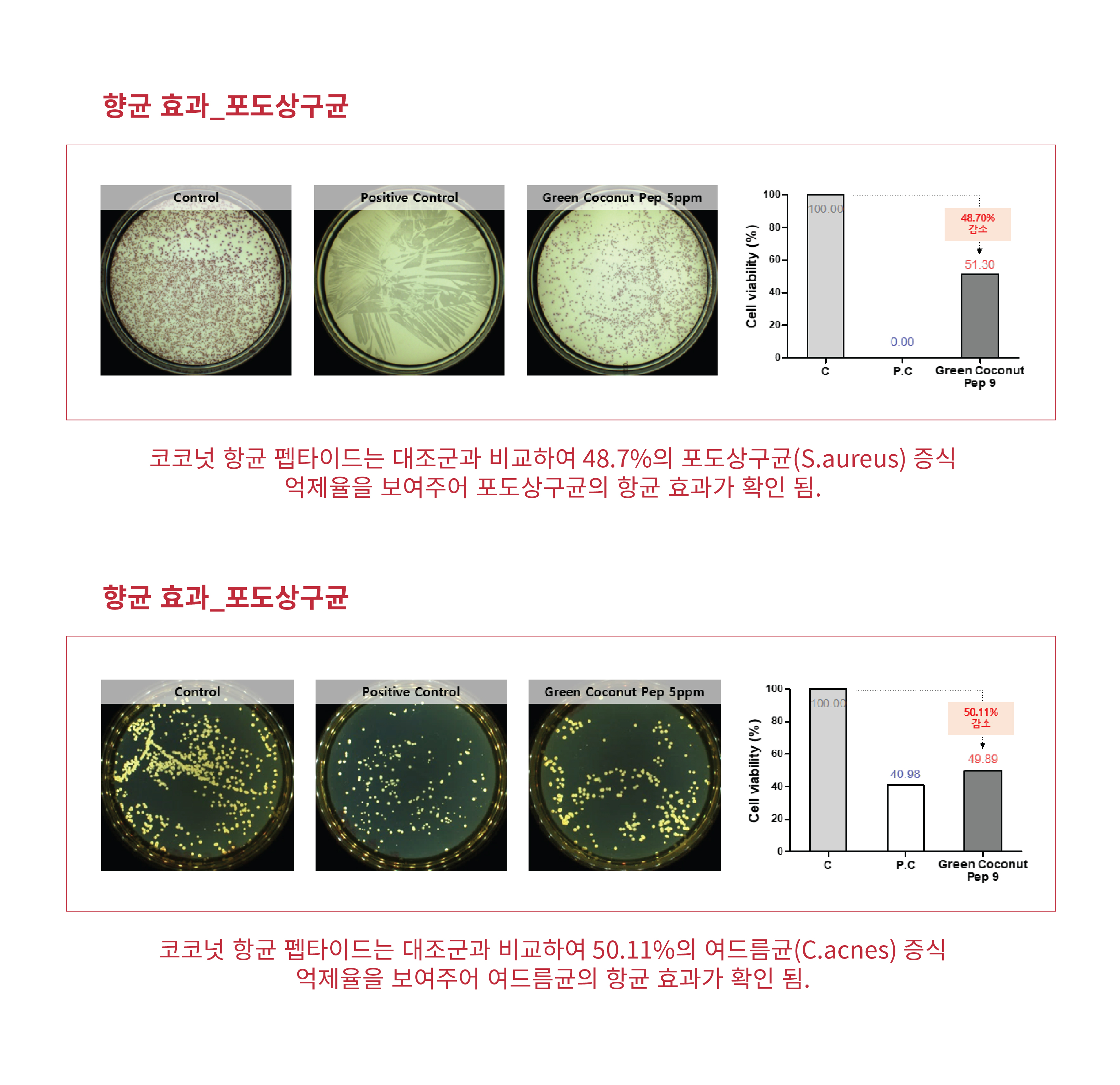 exVivo(내용)