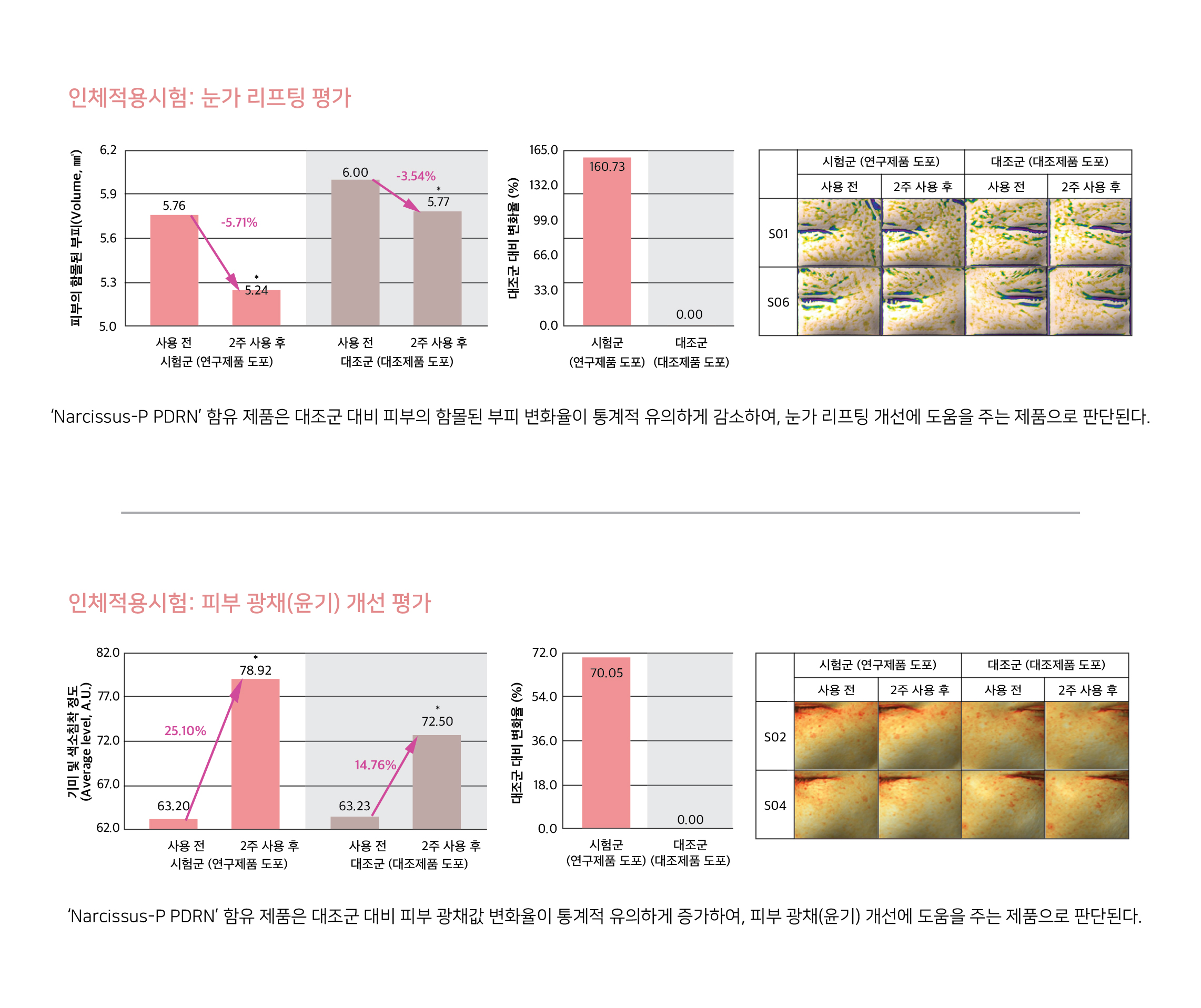 임상시험(내용)